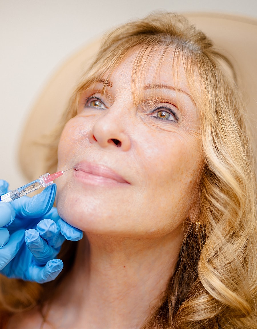 Woman receiving lip filler treatment.